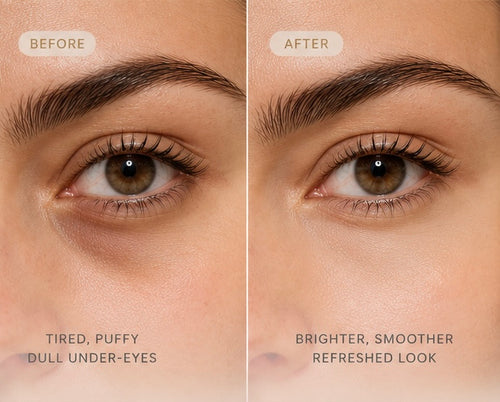 AURA+ EyeRevive™ Patches